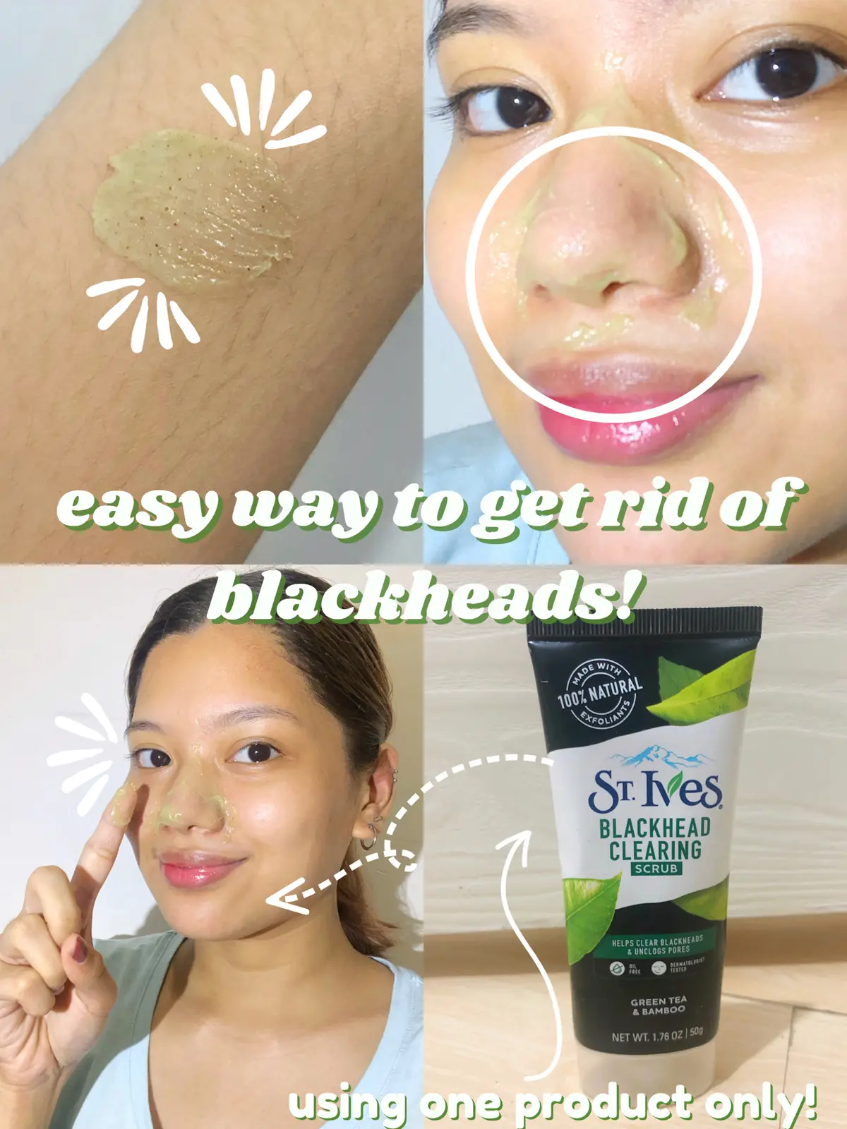 EASY WAY TO GET RID OF BLACKHEADS! Gallery posted by bien Lemon8