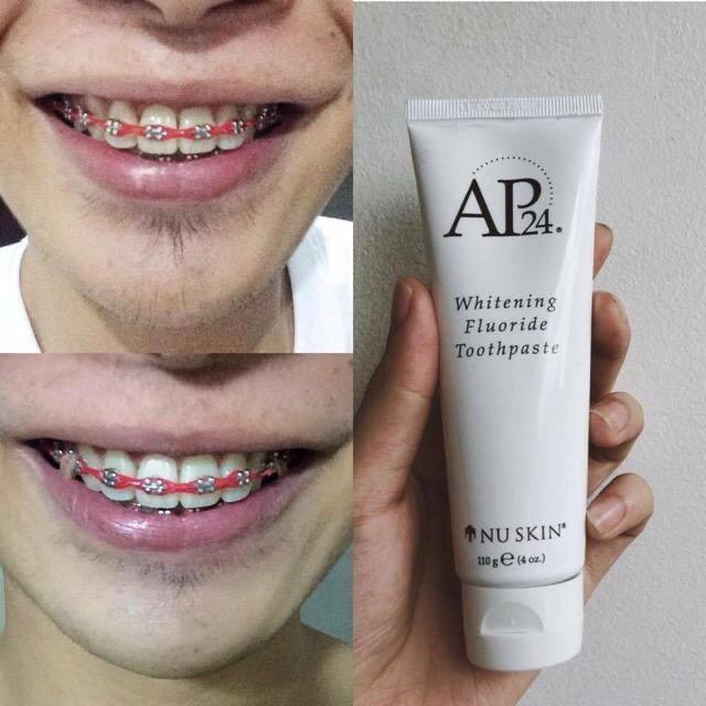 ap24 toothpaste dentist review