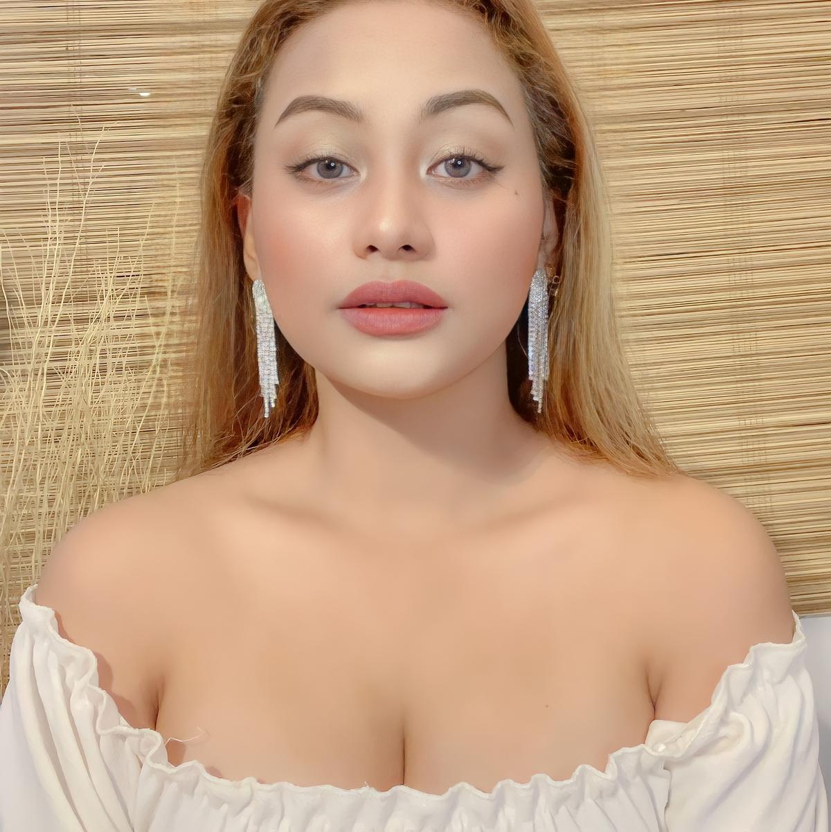  Trixie MB Lemon8